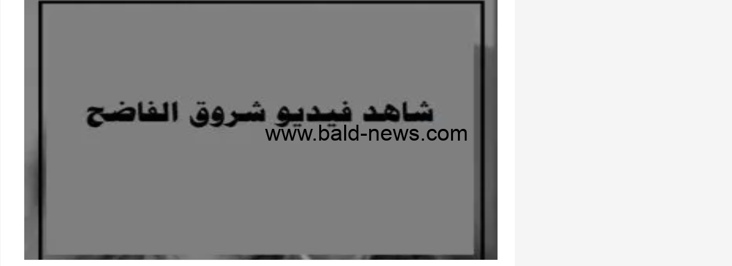 ” صن شاين ” فيديو فضيحة شروق المغربية المثير كامل TikTok يشعل مواقع التواصل الاجتماعي