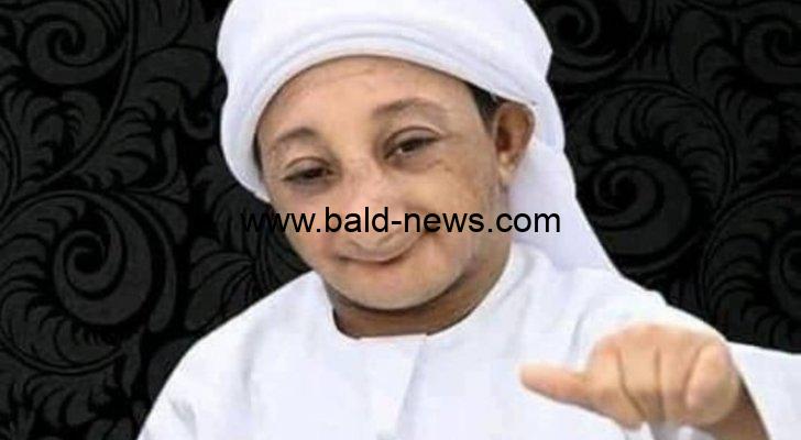 بسبب مرض لازمه طول حياته .. وفاة عزيز الأحمد اليوتيوبر السعودي في عز شبابه