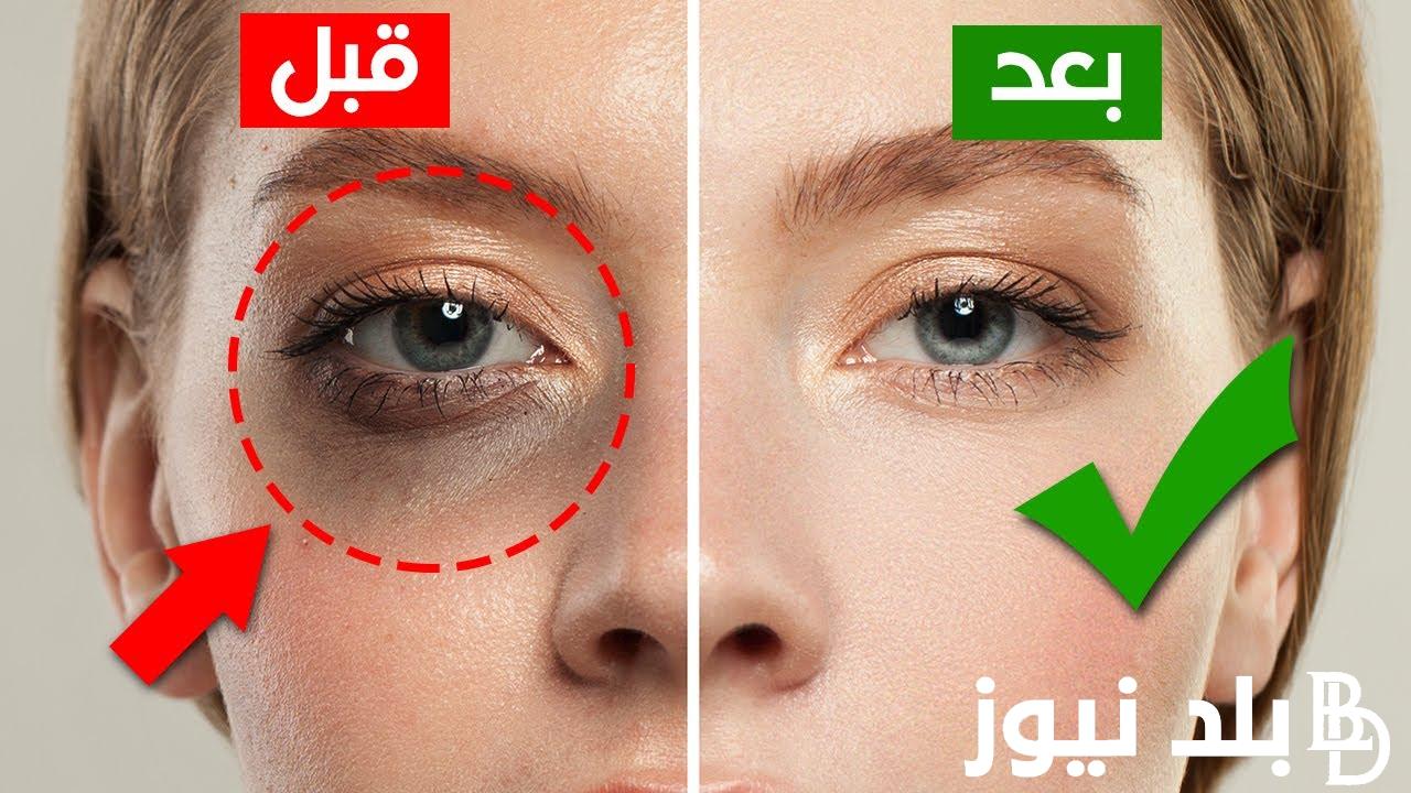 اسرع وصفة للهالات السوداء بالاعشاب والطرق الطبيعية